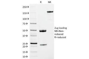 SDS-PAGE (SDS) image for Mouse anti-Human IgM Heavy Chain antibody (ABIN3026664)