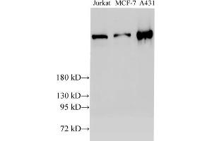 Western Blot analysis of Jurkat, MCF-7 and A431 cells using BRCA2 Polyclonal Antibody at dilution of 1:2000