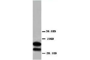 Western blot analysis of rat brain tissue lysis using MBP antibody (MBP antibody  (C-Term))