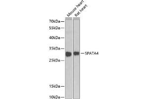 Western blot analysis of extracts of various cell lines, using SP antibody (ABIN6129759, ABIN6148328, ABIN6148329 and ABIN6223522) at 1:1000 dilution. (SPATA4 antibody  (AA 1-250))