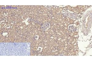 Immunohistochemistry of paraffin-embedded Rat kidney tissue using GLUT-4 Polyclonal Antibody at dilution of 1:200. (GLUT4 antibody)
