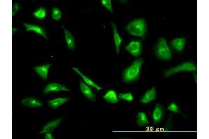 Immunofluorescence of monoclonal antibody to CPVL on HeLa cell. (CPVL antibody  (AA 1-476))