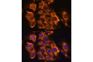 Immunofluorescence analysis of C6 cells using CRELD1 antibody (ABIN7266621) at dilution of 1:100. (CRELD1 antibody  (AA 50-150))