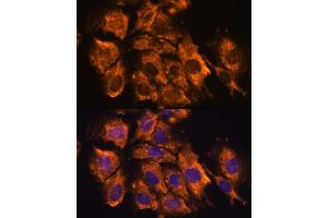 Immunofluorescence analysis of C6 cells using CRELD1 antibody (ABIN7266621) at dilution of 1:100.