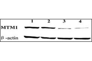 Western blot showing knockdown of endogenous MTM1 expression by MTM1-targeting vectors pD and pD. (MTM1 antibody  (C-Term))