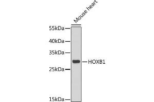 Western blot analysis of extracts of mouse heart, using HOXB1 antibody (ABIN6128032, ABIN6141942, ABIN6141943 and ABIN6222309) at 1:1000 dilution. (HOXB1 antibody  (AA 35-180))