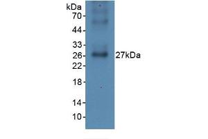 WB of Protein Standard: different control antibodies against Highly purified E. (CRP ELISA Kit)
