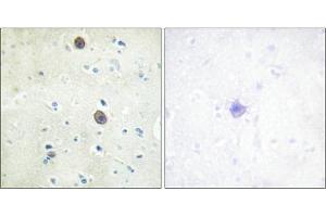 Immunohistochemical analysis of paraffin-embedded human brain tissue using Amyloid β A4 (phospho-Thr743/668) antibody (left)or the same antibody preincubated with blocking peptide (right). (APP antibody  (pThr743))