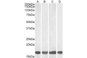 ABIN184738 (1µg/ml) staining of Human Brain (Frontal Cortex (A) Rat (B) Mouse (C) Brain and Swine E) Brain   lysates (35µg protein in RIPA buffer).