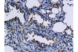 Formalin-fixed and paraffin embedded mouse lung labeled with Anti-TNFSF15/TL1A Polyclonal Antibody, Unconjugated (ABIN709556) followed by conjugation to the secondary antibody and DAB staining (TNFSF15 antibody  (AA 161-251))
