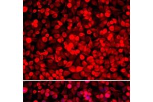 Immunofluorescence analysis of HeLa cells using PUF60 Polyclonal Antibody (PUF60 antibody)