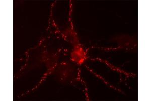 Immunocytochemistry on cultured hippocampus neurons (dilution 1 : 300). (Bassoon antibody  (C-Term))