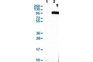 Western Blot analysis of (1) Negative control (vector only transfected HEK293T lysate), and (2) Over-expression lysate (Co-expressed with a C-terminal myc-DDK tag (~3. (SYT16 antibody  (AA 444-592))