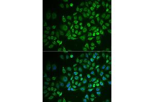Immunofluorescence analysis of A549 cell using GPLD1 antibody. (GPLD1 antibody)
