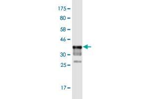 Western Blotting (WB) image for anti-Lysine (K)-Specific Demethylase 5D (KDM5D) (AA 127-230) antibody (ABIN2565646)