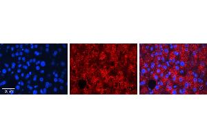 Immunohistochemistry (IHC) image for anti-Ras Homolog Family Member D (RHOD) (N-Term) antibody (ABIN2775403) (RHOD antibody  (N-Term))