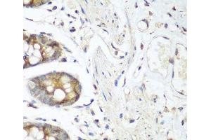 Immunohistochemistry of paraffin-embedded Human colon using FLT4 Polyclonal Antibody at dilution of 1:200 (40x lens). (FLT4 antibody)