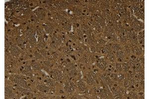 ABIN6274032 at 1/100 staining Rat brain tissue by IHC-P. (HSF1 antibody  (pSer326))