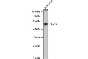 Western blot analysis of extracts of NCI-H125 cells using CD1B Polyclonal Antibody at dilution of 1:1000. (CD1b antibody)