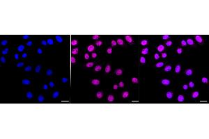 Immunocytochemical staining of HepG2 cells with Chromodomain helicase DNA binding protein 4 antibody (ABIN7800918), 1:1,000). (Recombinant Chromodomain Helicase DNA Binding 4 antibody)