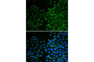 Immunofluorescence analysis of U2OS cells using NR0B2 antibody (ABIN5970937). (NR0B2 antibody)