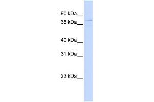 WB Suggested Anti-ZBTB3 Antibody Titration:  0.