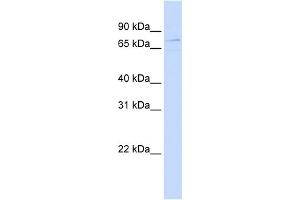 WB Suggested Anti-ZBTB3 Antibody Titration:  0. (ZBTB3 antibody  (Middle Region))