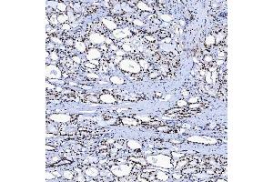 IHC analysis of SF3B3 using anti-SF3B3 antibody (ABIN7602378).