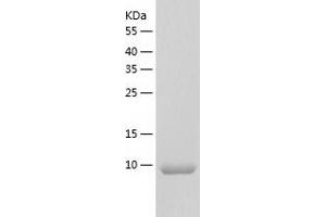 Western Blotting (WB) image for Colipase, Pancreatic (CLPS) (AA 18-112) protein (His tag) (ABIN7284958) (CLPS Protein (AA 18-112) (His tag))