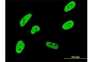 Immunofluorescence of monoclonal antibody to CDKL1 on HeLa cell. (CDKL1 antibody  (AA 259-358))