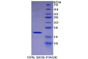 SDS-PAGE analysis of Mouse MBL2 Protein. (MBL2 Protein)
