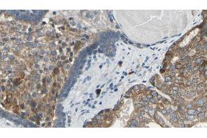 ABIN6269351 at 1/100 staining Human prostate tissue by IHC-P. (eIF4EBP1 antibody  (Internal Region))