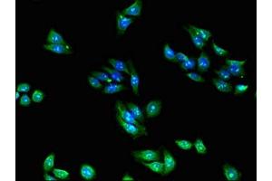 Immunofluorescent analysis of HepG2 cells using ABIN7142792 at dilution of 1:100