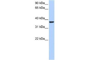 WB Suggested Anti-HMG20B Antibody Titration:  0. (HMG20B antibody  (Middle Region))