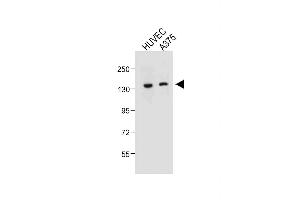 All lanes : Anti-TECPR1 Antibody (C-term) at 1:500 dilution Lane 1: HUVEC whole cell lysate Lane 2:  whole cell lysate Lysates/proteins at 20 μg per lane.