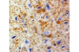 Used in DAB staining on fromalin fixed paraffin-embedded Brain tissue (CCL20 antibody  (AA 24-95))