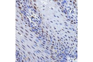 Immunohistochemistry of paraffin-embedded human esophageal using TP73 Rabbit pAb (ABIN6133470, ABIN6149430, ABIN6149431 and ABIN6213831) at dilution of 1:100 (40x lens). (Tumor Protein p73 antibody  (AA 1-100))