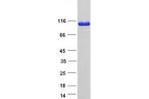 Validation with Western Blot