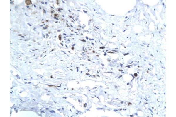 HEV ORF3 antibody  (AA 22-103)