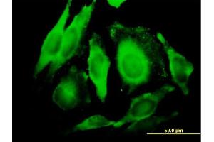 Immunofluorescence of purified MaxPab antibody to GGT1 on HeLa cell. (GGT1 antibody  (AA 1-569))