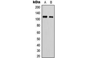 Western blot analysis of p116 Rip expression in Jurkat (A), rat muscle (B) whole cell lysates.