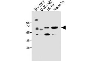 All lanes : Anti-CERK Antibody (C-term) at 1:1000 dilution Lane 1: SH-SY5Y whole cell lysate Lane 2: U-251 MG whole cell lysate Lane 3: HL-60 whole cell lysate Lane 4: Neuro-2a whole cell lysate Lysates/proteins at 20 μg per lane. (CERK antibody  (C-Term))