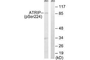 Western blot analysis of extracts from 292 cells, treated with UV (15 mins), using ATRIP (Phospho-Ser224) antibody. (ATRIP antibody  (pSer224))