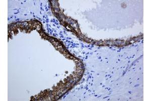 Image no. 1 for anti-Keratin 5 (KRT5) (AA 1-273) antibody (ABIN1490696) (Cytokeratin 5 antibody  (AA 1-273))