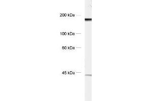 dilution: 1 : 1000, sample: crude synaptic vesicle fraction of rat brain (LP2) (SNAP91 antibody  (AA 279-297))