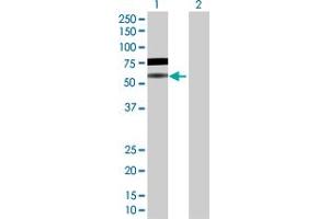 Western Blot analysis of BLNK expression in transfected 293T cell line by BLNK MaxPab polyclonal antibody. (B-Cell Linker antibody  (AA 1-456))
