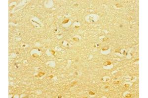 Immunohistochemistry of paraffin-embedded human brain tissue using ABIN7166564 at dilution of 1:100 (PCDH19 antibody  (AA 568-678))