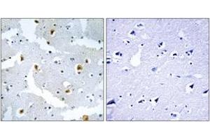 Immunohistochemistry analysis of paraffin-embedded human brain tissue, using FMN2 Antibody. (Formin 2 antibody  (AA 1541-1590))
