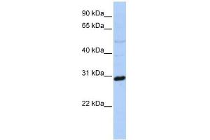 Metaxin 2 antibody used at 1 ug/ml to detect target protein. (MTX2 antibody  (N-Term))