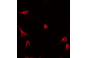 ABIN6266908 staining Hela by IF/ICC. (P18 INK antibody)